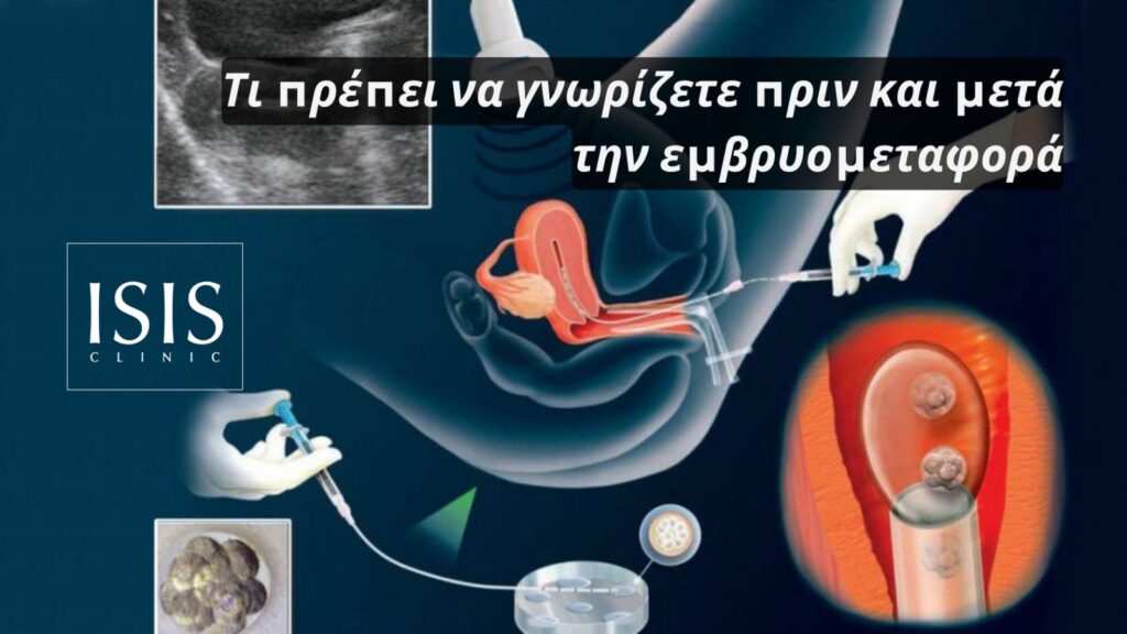 ivf-embryo-transfer-cyprus